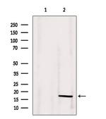 Angiogenin Antibody in Western Blot (WB)