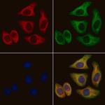 PAH Polyclonal Antibody