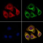 NAT1 Polyclonal Antibody