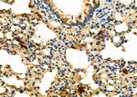 NAT1 Antibody in Immunohistochemistry (Paraffin) (IHC (P))