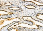 IFN beta Polyclonal Antibody