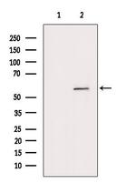 MYOC Polyclonal Antibody