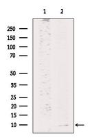 HAMP Polyclonal Antibody