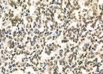 TAP2 Antibody in Immunohistochemistry (Paraffin) (IHC (P))