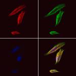 HLA-DRB3 Polyclonal Antibody