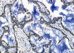 HLA-DRB3 Antibody in Immunohistochemistry (Paraffin) (IHC (P))