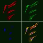 FABP2 Polyclonal Antibody