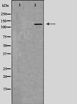 RFC1 Antibody in Western Blot (WB)