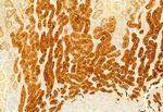 S100A4 Antibody in Immunohistochemistry (Paraffin) (IHC (P))