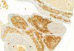 S100A4 Antibody in Immunohistochemistry (Paraffin) (IHC (P))