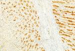 S100A4 Antibody in Immunohistochemistry (Paraffin) (IHC (P))
