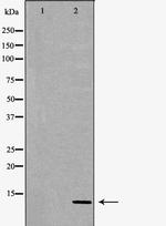 S100A4 Antibody in Western Blot (WB)