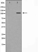 RASA1 Polyclonal Antibody