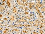 LOX-1 Polyclonal Antibody