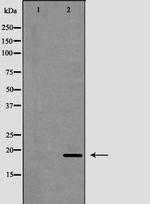 Cathelicidin Polyclonal Antibody