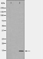 SAA1/SAA2 Antibody in Western Blot (WB)
