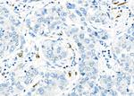 CD162 Antibody in Immunohistochemistry (Paraffin) (IHC (P))