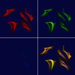 KIR2DL3 Polyclonal Antibody