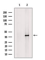 KIR2DL3 Antibody in Western Blot (WB)