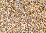 WFS1 Polyclonal Antibody