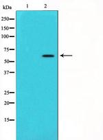 CYP11A1 Polyclonal Antibody