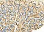 IGFBP5 Polyclonal Antibody
