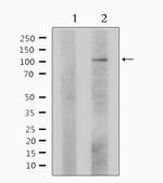 DNA ligase IV Antibody in Western Blot (WB)