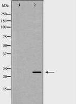 FXN Polyclonal Antibody