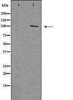 MTTP Polyclonal Antibody