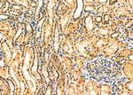 CSN5 Polyclonal Antibody