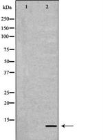 APOC2 Antibody in Western Blot (WB)