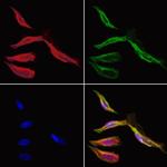 HMBS Polyclonal Antibody