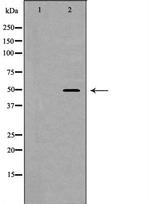 MOK Polyclonal Antibody
