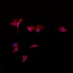 RGS2 Polyclonal Antibody