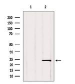 RGS2 Antibody in Western Blot (WB)