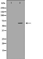 IL10RA Polyclonal Antibody