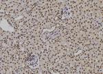 POLH Polyclonal Antibody