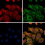 SFTPC Polyclonal Antibody