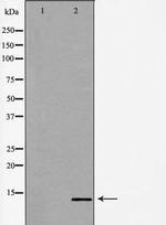 POLR2J Polyclonal Antibody