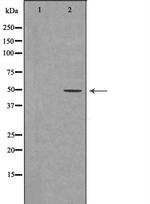 DDB2 Polyclonal Antibody