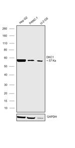 DKC1 Polyclonal Antibody