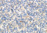 IL24 Polyclonal Antibody