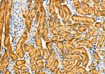 ANT Polyclonal Antibody