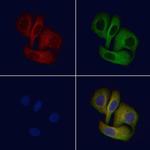 EPHX2 Polyclonal Antibody