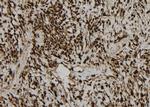 DNA Ligase III Polyclonal Antibody