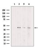 PDHA1 Polyclonal Antibody