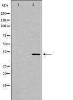 MNAT1 Antibody in Western Blot (WB)