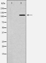 Bub1 Polyclonal Antibody