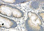 RAB27A Antibody in Immunohistochemistry (Paraffin) (IHC (P))