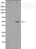 Prostate Specific Acid Phosphatase Antibody in Western Blot (WB)